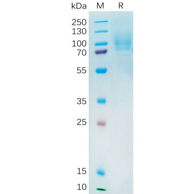 sp-pme100544 yap1 sp1