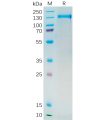 sp-pme100546 psma sp1