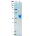 sp-pme100547 muc1 sp1