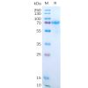 sp-pme100548 il15ra sp1