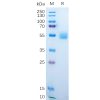 sp-pme100549 amhr2 sp1