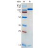 sp-pme100562 pcsk9 sp1