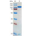 sp-pme100562 pcsk9 sp1