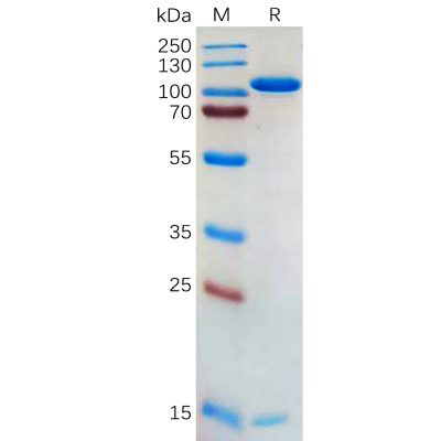 sp-pme100562 pcsk9 sp1