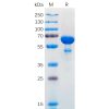 sp-pme100567 bcl2l1 sp1