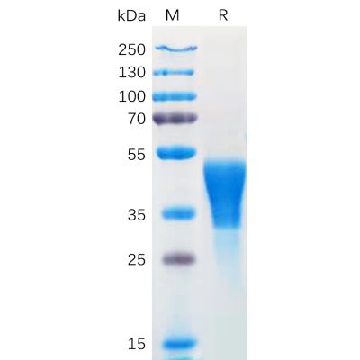 sp-pme100569 m csf sp1