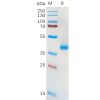 sp-pme100572 slc7a11 sp1