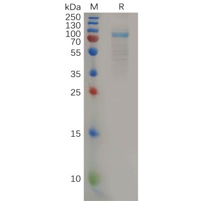 sp-pme100578 il11ra sp1