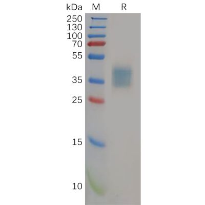 sp-pme100587 il21r sp1