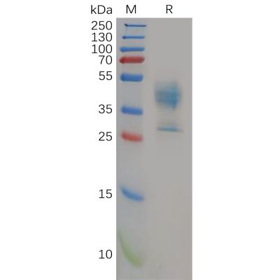 sp-pme100589 mdr 1 sp1