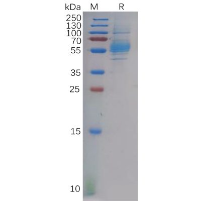 sp-pme100610 clec9a sp1