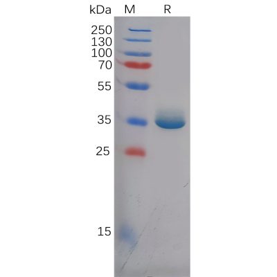 sp-pme100617 ereg sp1