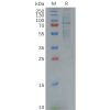 sp-pme100619 gas6 sp1