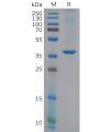 sp-pme100623 chi3l1 sp1