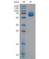 sp-pme100624 epha4 sp1