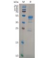 sp-pme100634 mmp9 sp1