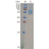 sp-pme100645 siglec7 sp1