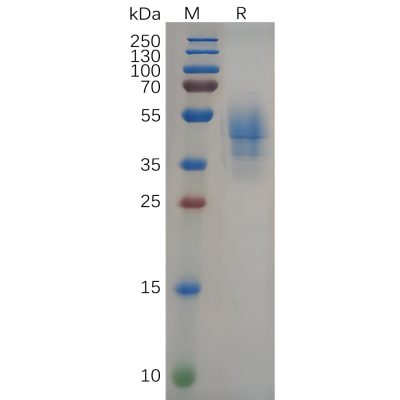 sp-pme100654 nefl sp1