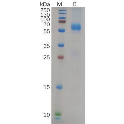 sp-pme100657 nucleocapsid sp1