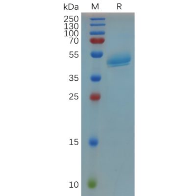 sp-pme100671 rspo3 sp1