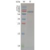 sp-pme100675 mmp14 sp1