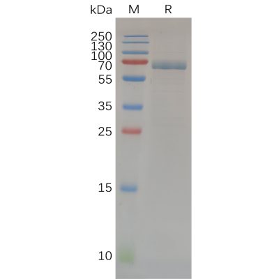 sp-pme100675 mmp14 sp1