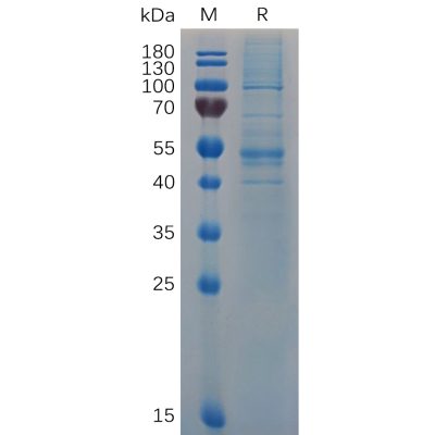 sp-pme100682 ifnb1 sp1