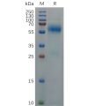 sp-pme100688 nucleocapsid sp1