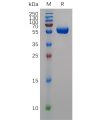 sp-pme100711 mmp9 sp1