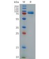 sp-pme100718 stab1 sp1