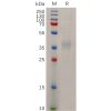 sp-pme100720 npc1l1 sp1