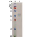 sp-pme100720 npc1l1 sp1