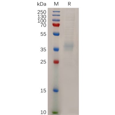 sp-pme100720 npc1l1 sp1