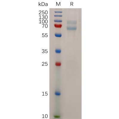 sp-pme100721 adam28 sp1
