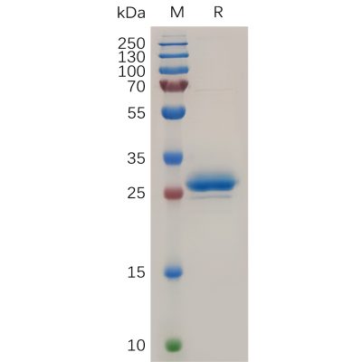 sp-pme100724 mesothelin sp1