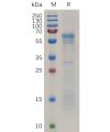 sp-pme100727 prnp sp1