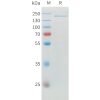 sp-pme100742 adamts13 sp1