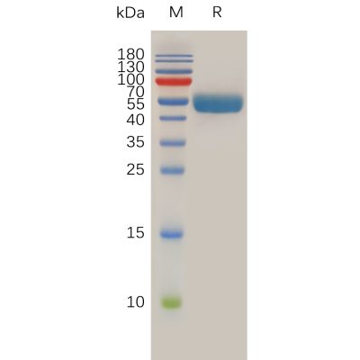 sp-pme100761 rnf43 sp1