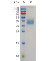 sp-pme100766 trop2 sp1