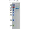 sp-pme100772 s protein rbd sp1