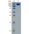 sp-pme100773 ifnar1 sp1