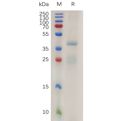 sp-pme100779 rspo1 sp1