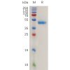 sp-pme100780 rspo1 sp1