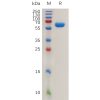 sp-pme100786 ca12 sp1