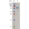 sp-pme100788 il18rap sp1