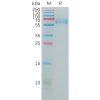 sp-pme100812 cd147 sp1