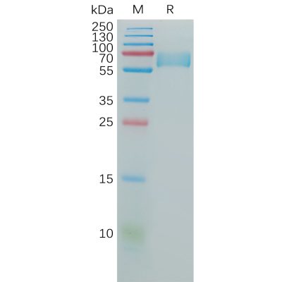 sp-pme100812 cd147 sp1