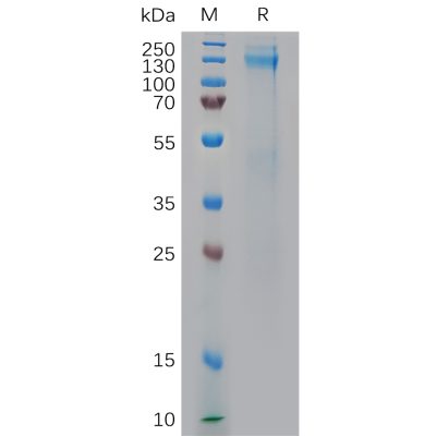 sp-pme100814 igf 1r sp1