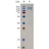 sp-pme100821 mst1r sp1