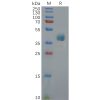 sp-pme100833 cxcr3 sp1
